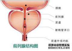 前列腺炎怎么治疗?